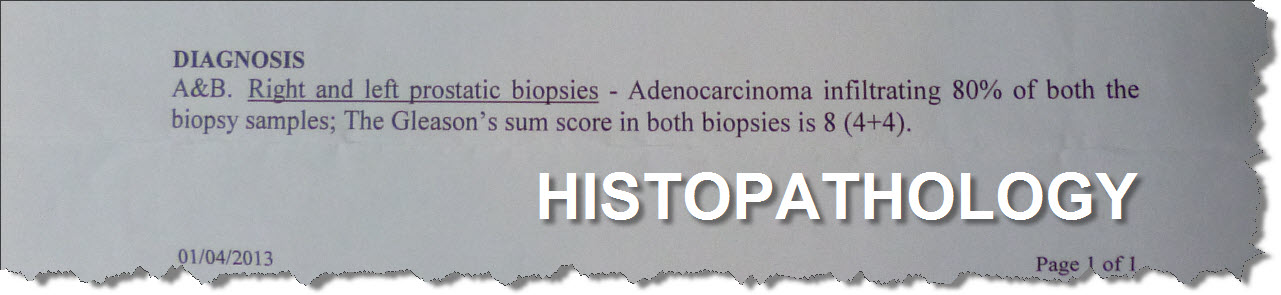 YMT Advanced Prostate Cancer Clinical History